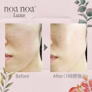 画像2: noa noa Luxe（ノア ノア リュクス） CO2 スキンミスト（店販用）150g