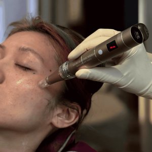 画像2: MICRO SILICONE DERMA (マイクロシリコンダーマ)(店販用)