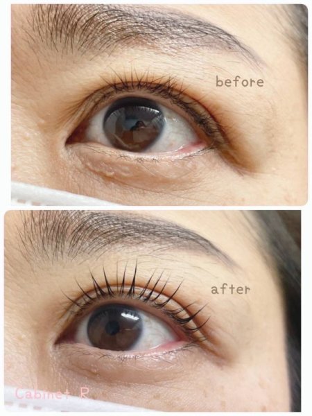 画像4: R eyelash serum Rアイラッシュセラム (旧:まつ毛美容液「蓮」REN) (4)